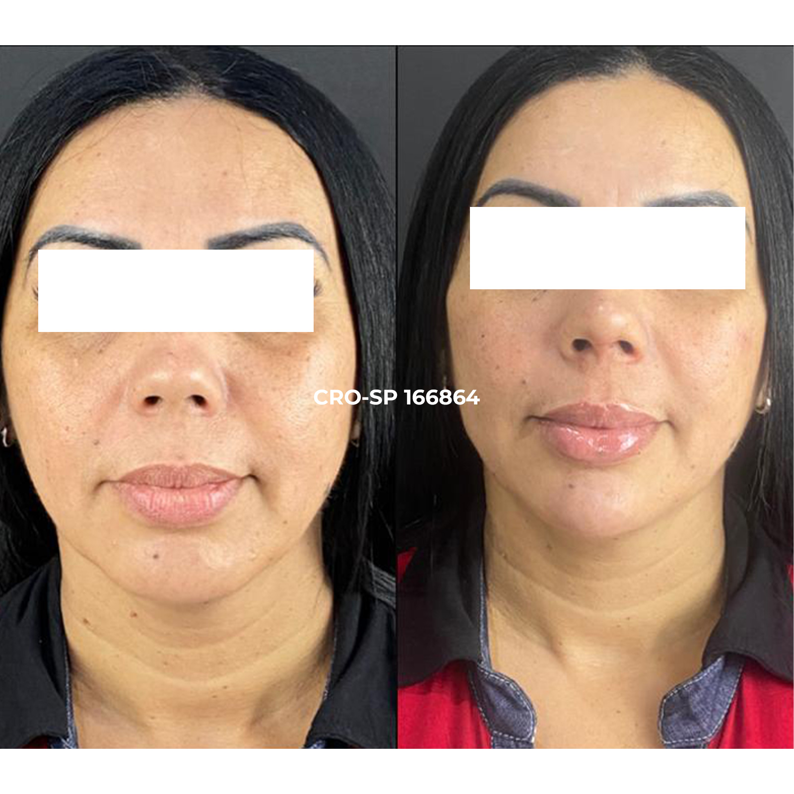 Transformação estética dental Sorocaba
